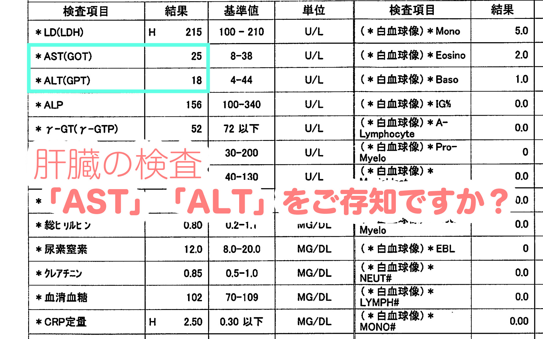 肝臓の検査「AST」「ALT」をご存知ですか？ | 医療法人社団 西宮回生病院