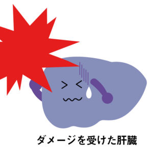 ダメージを受けた肝臓