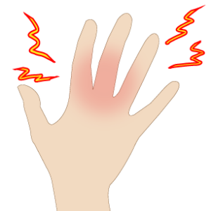 関節リウマチ_手の痺れ_06