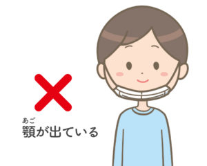 顎が出ている