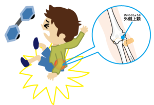 ブレイブボード転倒