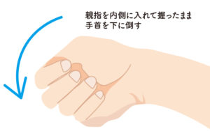 腱鞘炎の検査方法