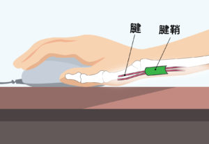 そもそも腱鞘とは