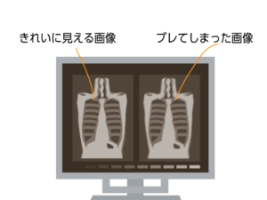レントゲン撮影