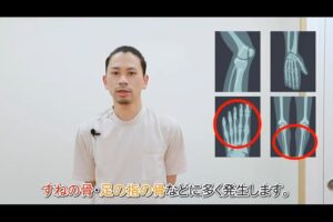 【動画解説】おさらい疲労骨折